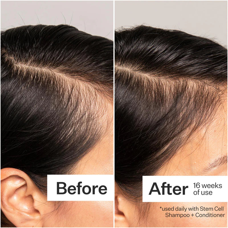 Act + Acre 3% Stem Cell Peptide Treatment