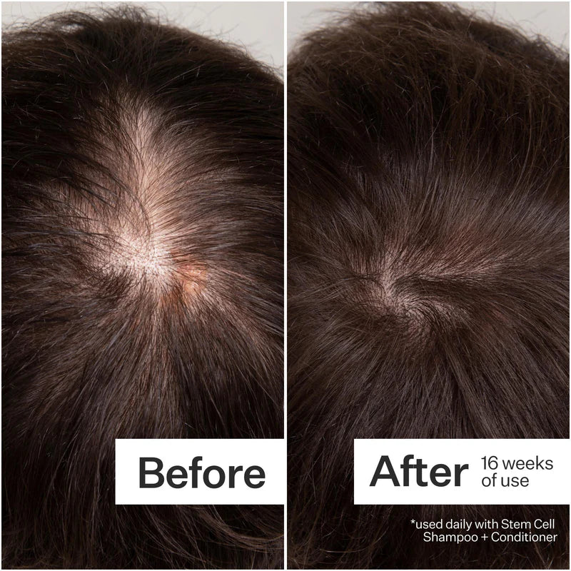 Act + Acre 3% Stem Cell Peptide Treatment