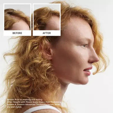 Nioxin System Kit 4