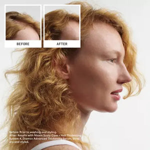 Nioxin System Kit 4