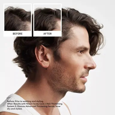 Nioxin System Kit 2